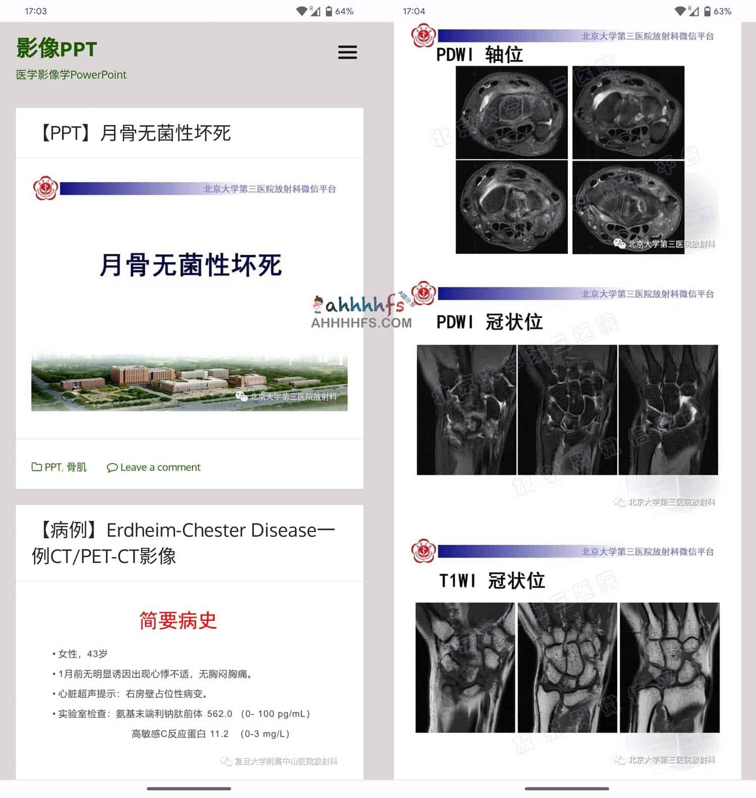 医学影像专业 PPT 模板库：高质量临床影像演示资源下载